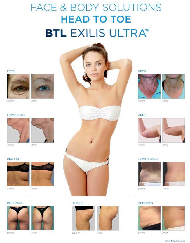 exilis-bna